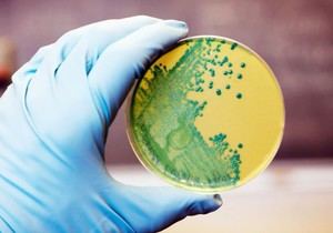 Investigadores crean un método innovador para erradicar la listeria en alimentos