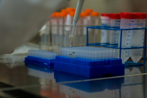 Colaboración entre Fisabio y la UJI para investigar la síndrome de Smith-Lemli-Opitz